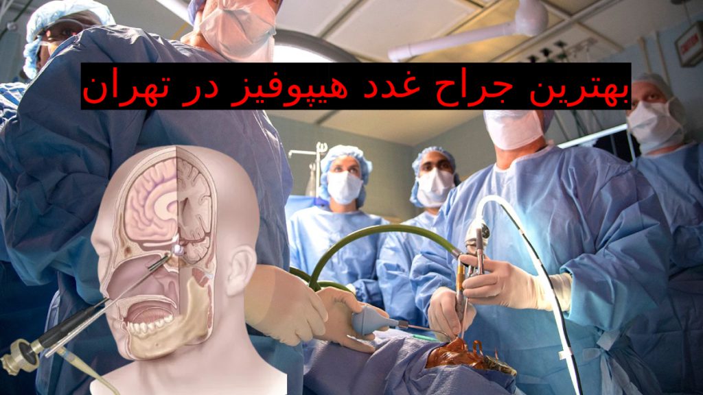 تیم جراحی در حال جراحی غدد هیپوفیز - بهترین متخصص هیپوفیز در تهران