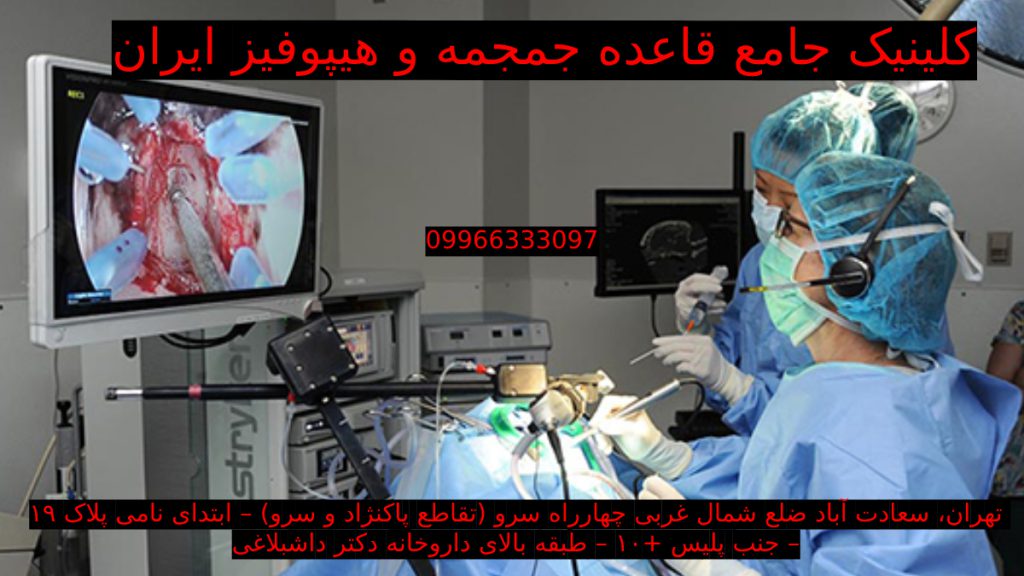 pituitary-gland بهترین مرکز جراحی غده هیپوفیز در تهران تیم جراحی غدد