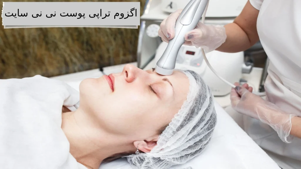 اگزوم تراپی پوست نی نی سایت معرفی اگزوم پوست به همراه هزینه و بهترین کلینیک اگزوم تراپی