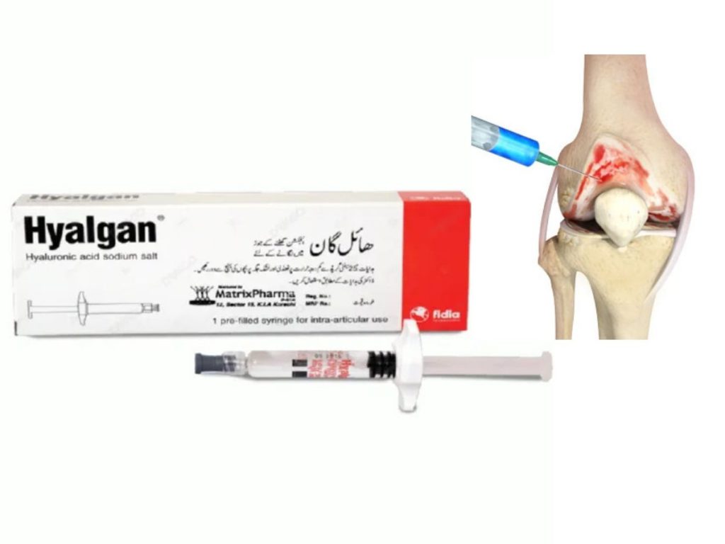 آمپول زانو تزریق هیالگان زانو