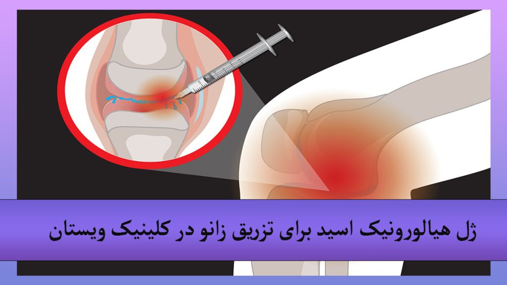 قیمت آمپول هیالگان