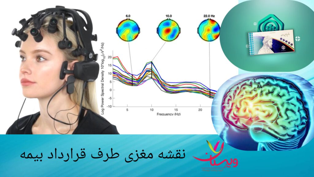 تصویری نمایشی از فعالیت های امواج مغز در نقشه مغزی بیمار