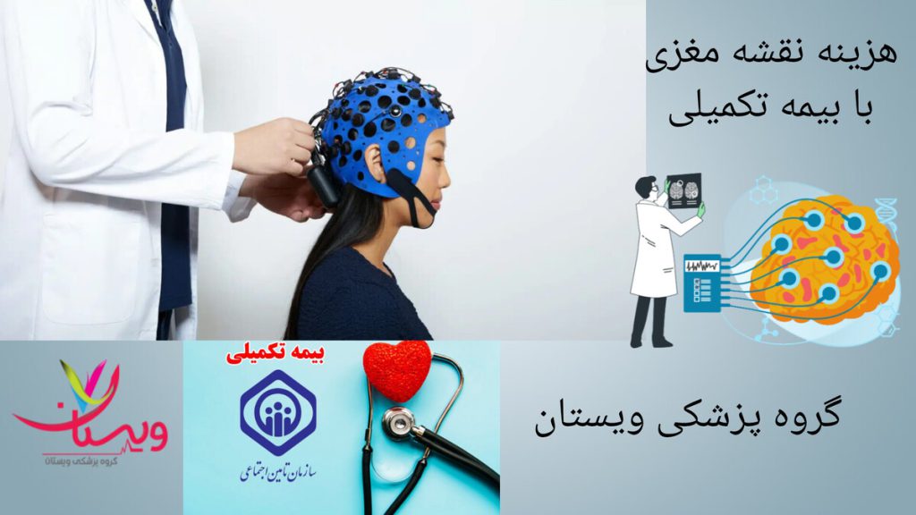 پزشک در حال انجام نقشه مغزی و نقشه مغزی طرف قرارداد بیمه تکمیلی