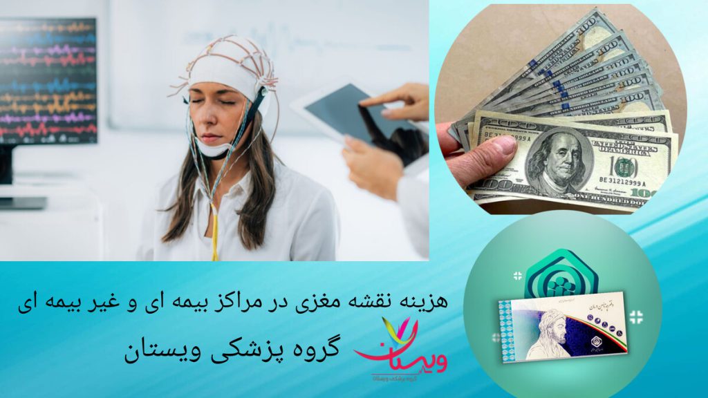انجام نقشه مغزی در مراکز بیمه ای