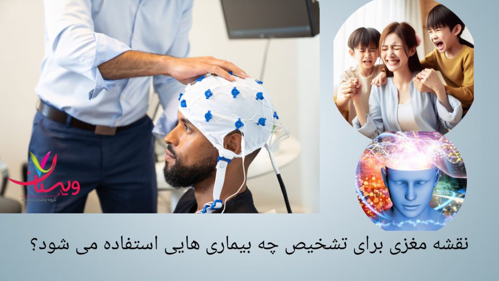انجام ننقشه مغزی برای فردی که دچار اختلالات مغزی شده است