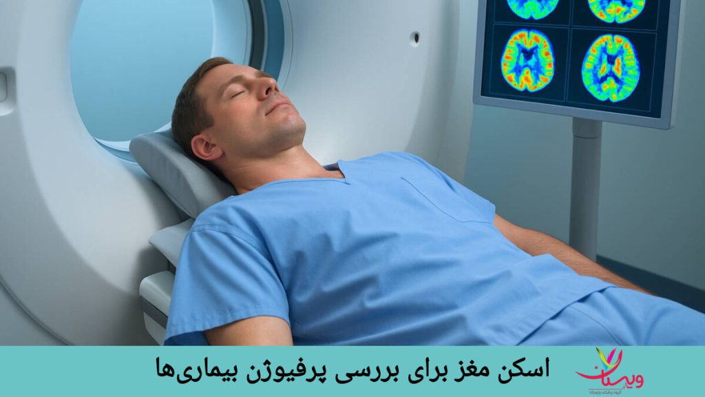 بیمار روی تخت دراز کشده و برای اسکن مغز آماده شده است.