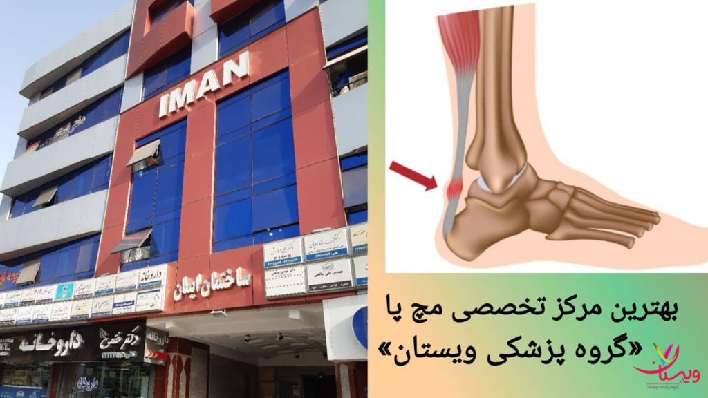 کلینیک ویستان، مرکز فوق تخصصی درمان مچ پا نمای بیرونی مرکز تخصصی مچ پا ویستان، در