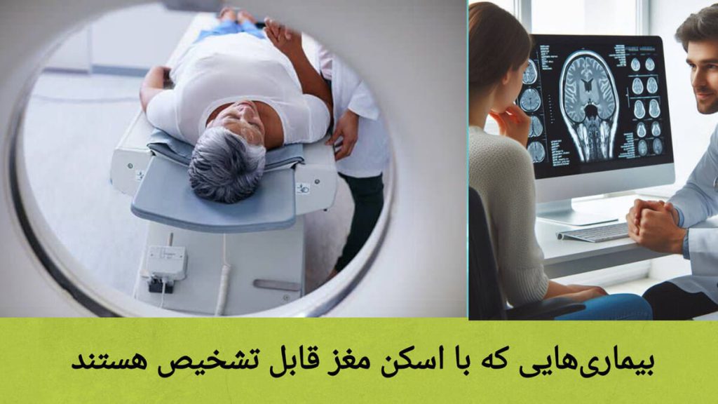 انجام اسکن مغز و تشخیص بیماری ها با اسکن