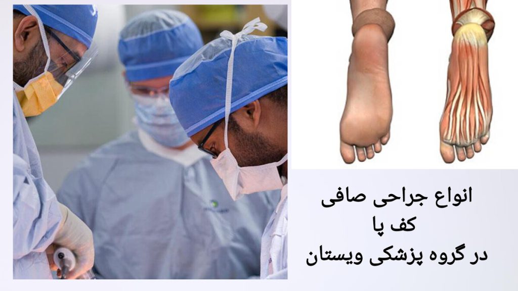 انجام جراحی برای درمان صافی کف پا جراحان در حال جراحی صافی کف پای بیمار