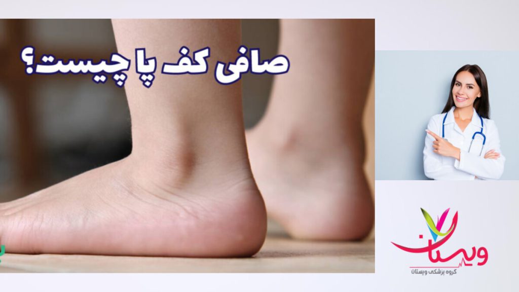 نداشتن قوس در کف پا، در صافی کف پا پزشک متخصص و فردی که صافی کف پا دارد