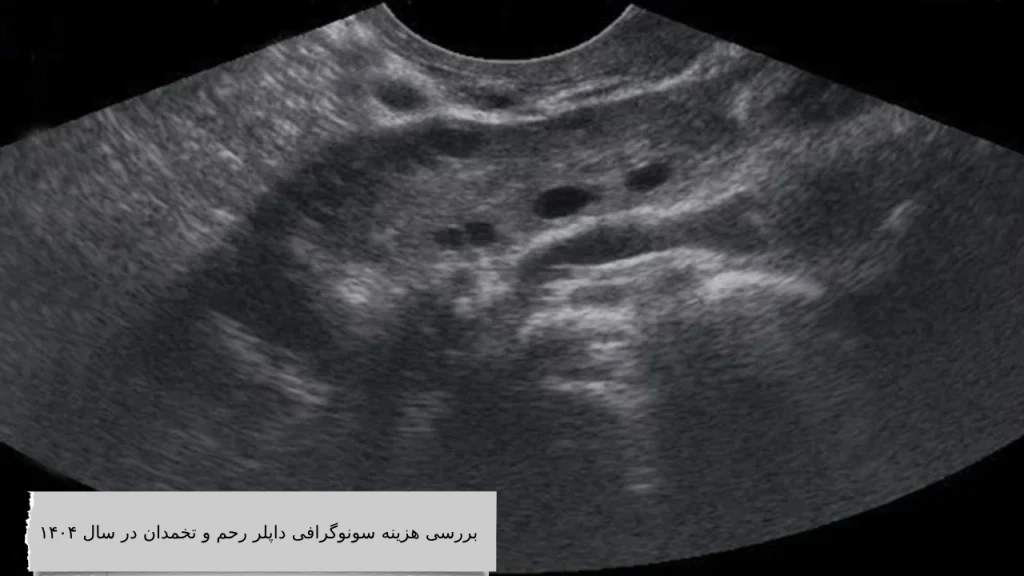 بررسی هزینه سونوگرافی داپلر رحم و تخمدان در سال ۱۴۰۴ بررسی هزینه سونوگرافی داپلر رحم و تخمدان در سال ۱۴۰۵