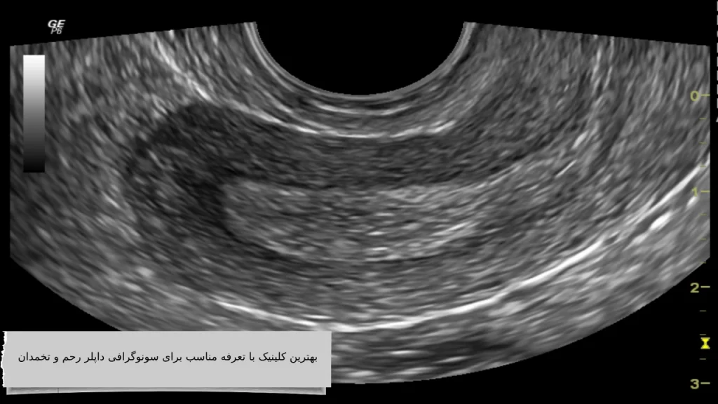 بهترین کلینیک با تعرفه مناسب برای سونوگرافی داپلر رحم و تخمدان بهترین کلینیک با تعرفه مناسب برای سونوگرافی داپلر رحم و تخمدان