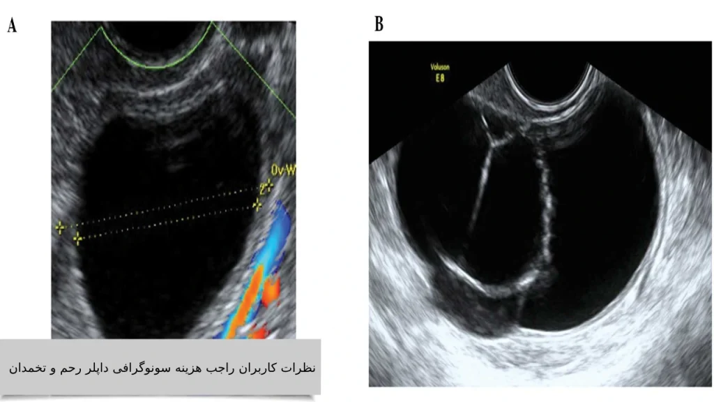 نظرات کاربران راجب هزینه سونوگرافی داپلر رحم و تخمدان