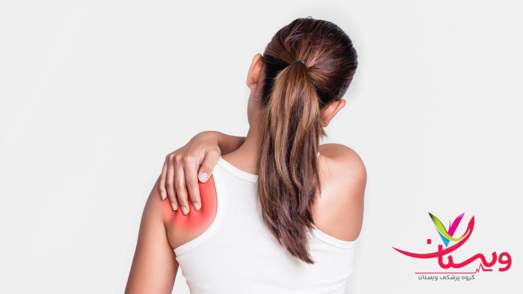 Cramps-behind-shoulder درمان گرفتگی عضلات کتف و کمر