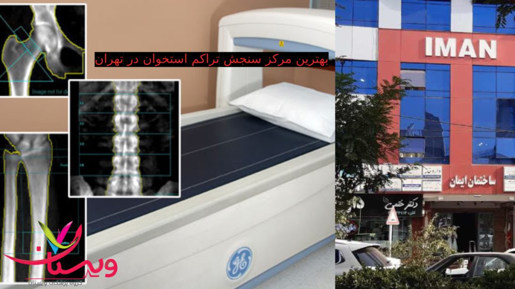بهترین مرکز سنجش تراکم استخوان در تهران