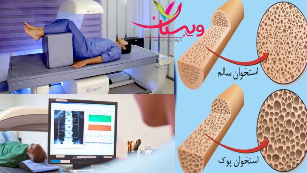 Bone-Densitometry جواب تست سنجش تراکم استخوان تشخیص پوکی استخوان