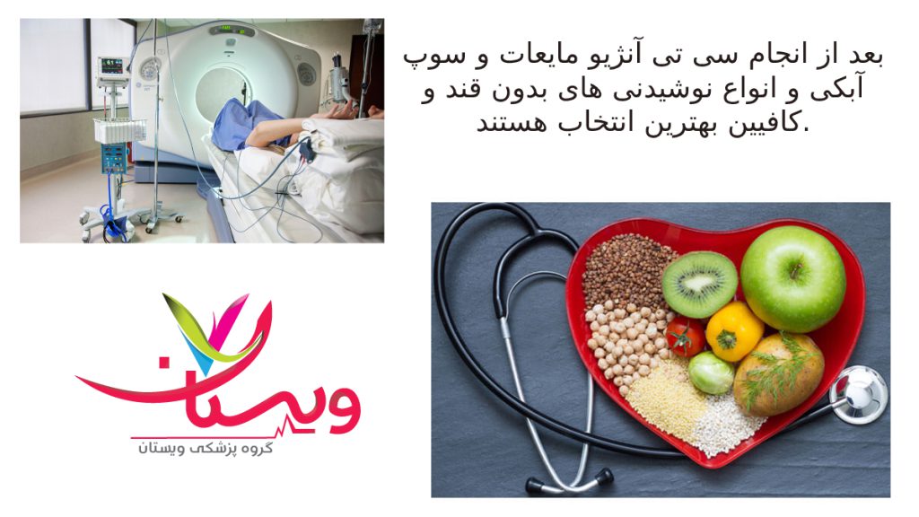 after ct angiography بعد از سی تی آنژیو چی بخوریم ؟
