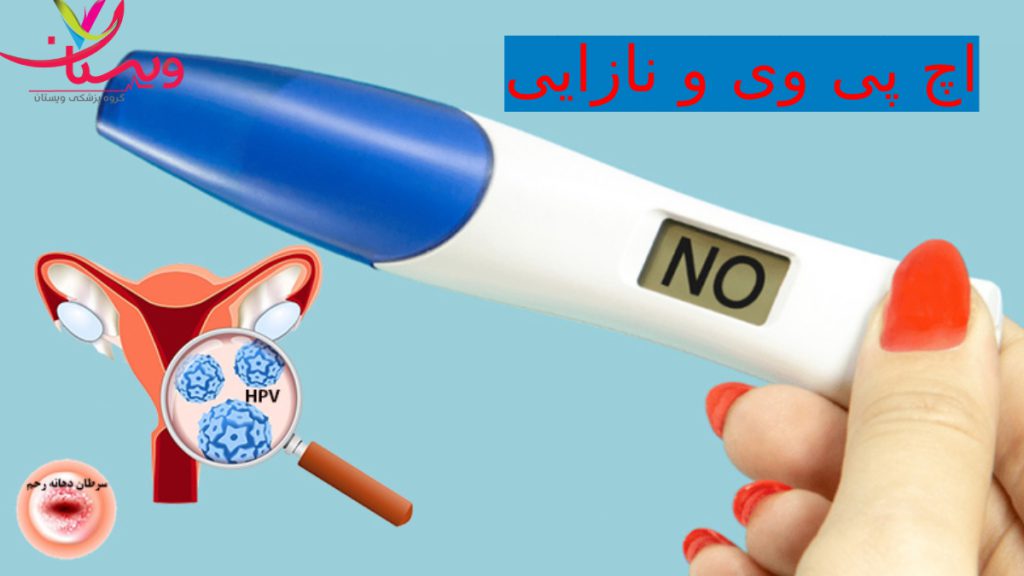 HPV-and-infertelity. ارتباط اچ پی وی و ناباروری