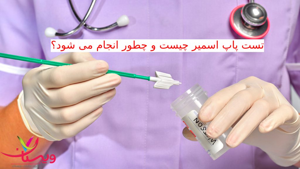 pap test نحوه انجام تست پاپ اسمیر- سواپ پاپ اسمیر به همراه نمونه بیمار در دست پزشک