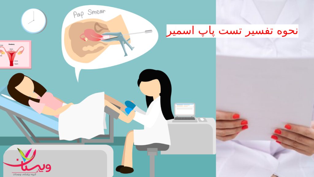 pap A تصویر انیمیشنی تست پاپ اسمیر توسط پزشک