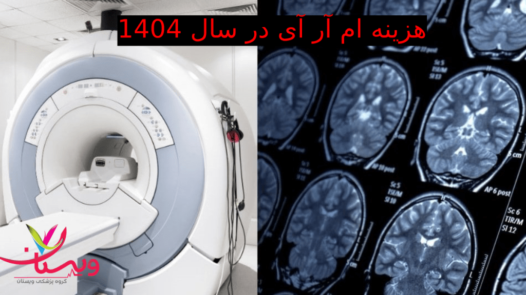 هزینه ام آر آی در سال 1404