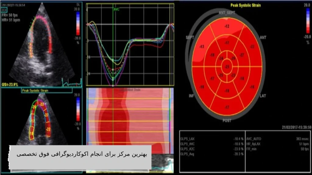 بهترین مرکز برای انجام اکوکاردیوگرافی فوق تخصصی