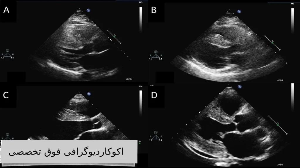 اکوکاردیوگرافی فوق تخصصی