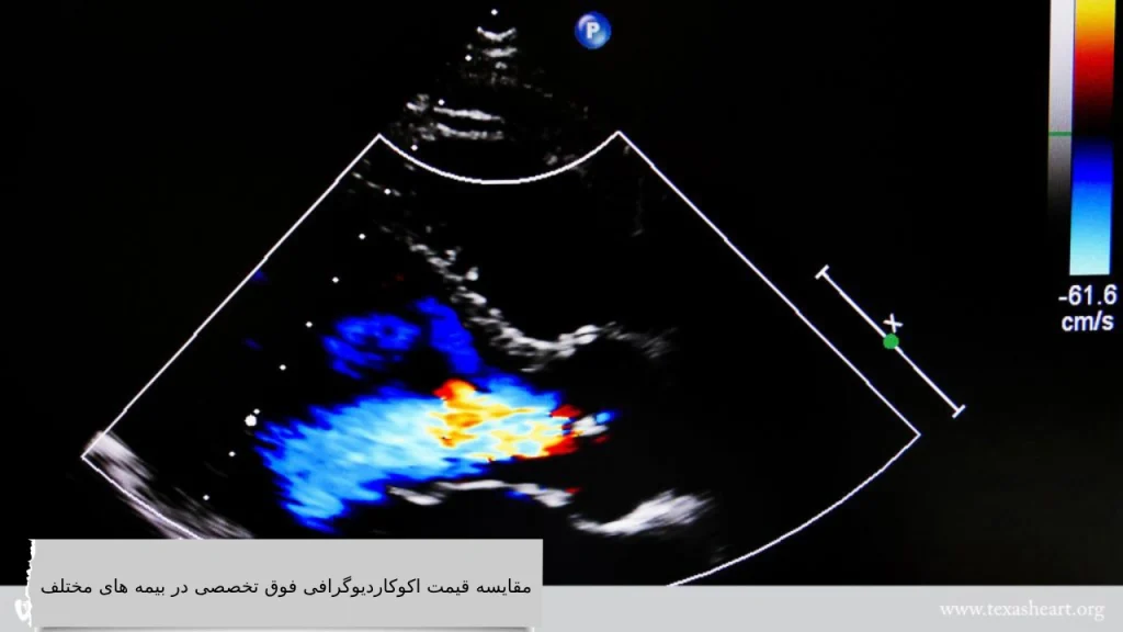 مقایسه قیمت اکوکاردیوگرافی فوق تخصصی در بیمه های مختلفمقایسه قیمت اکوکاردیوگرافی فوق تخصصی در بیمه های مختلف