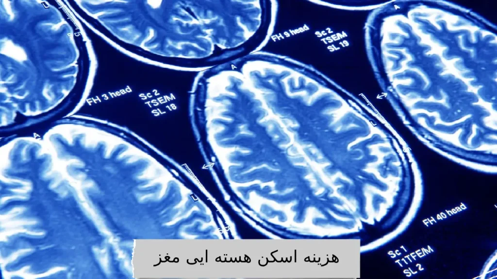 هزینه اسکن هسته ایی مغز