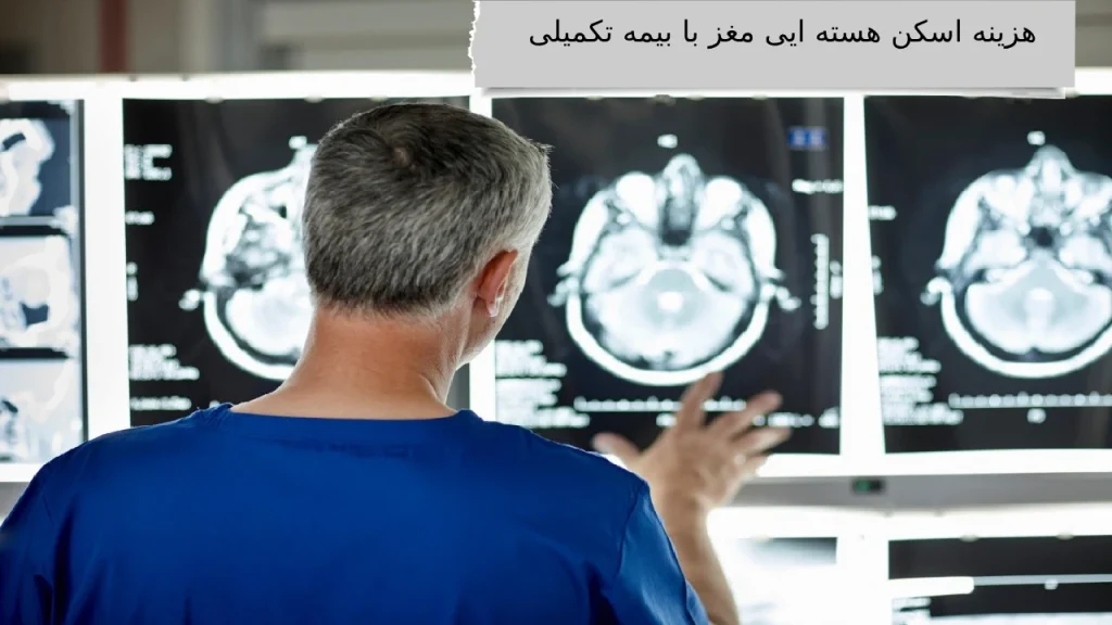 هزینه اسکن هسته ایی مغز با بیمه تکمیلی هزینه اسکن هسته ایی مغز با بیمه تکمیلی چقدر است؟