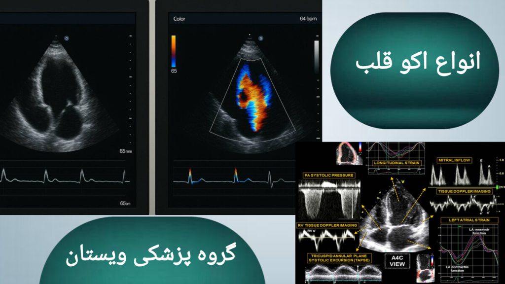 نمایی از انواع اکو قلب بیمار نشان داده می شود.