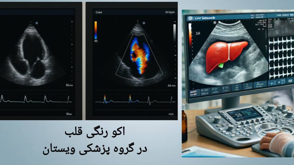 پزشک اکو قلب بیمار را بررسی می کند