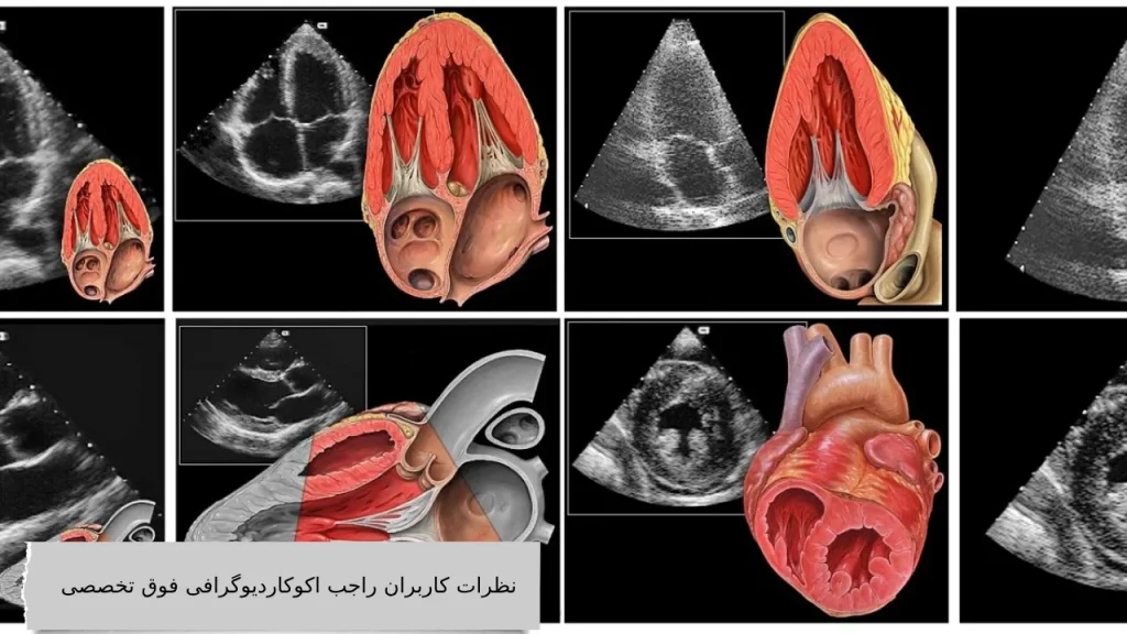 نظرات کاربران راجب اکوکاردیوگرافی فوق تخصصی