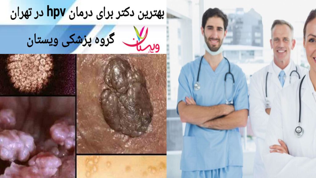 پزشک متخصص hpv در تهران نمایی از بهترین دکتر برای درمان hpv در تهران و تصویری از زگیل تناسلی