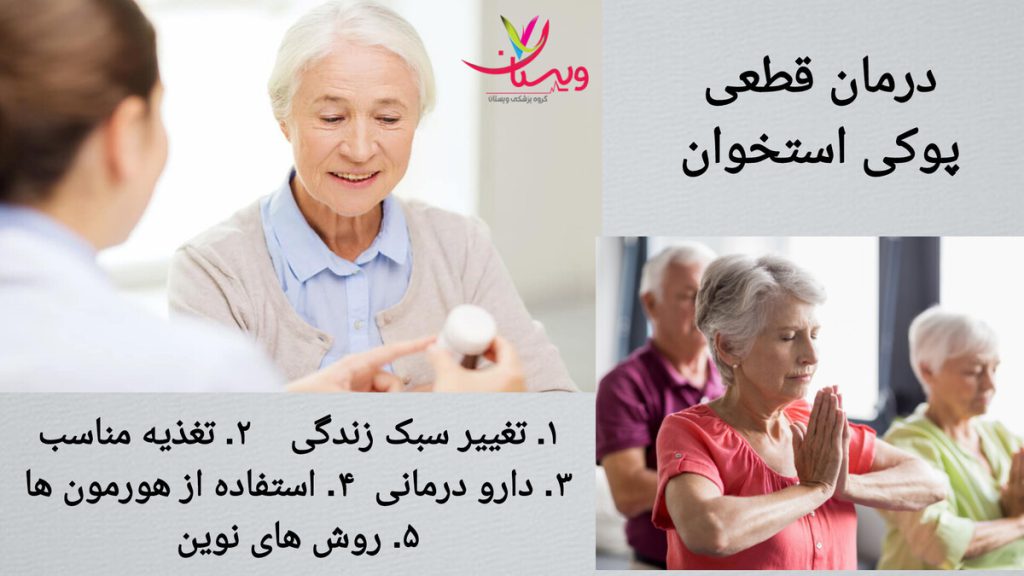 تجویز دارو به بیمار برای درمان قطعی پوکی استخوان پزشک برای درمان قطعی پوکی استخوان، به بیمار دارو می دهد.