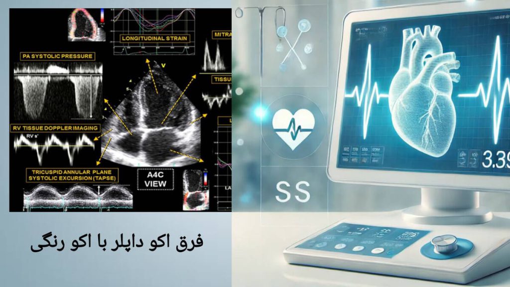 نمایی از اکو داپلر یا همان اکو رنگی قلب