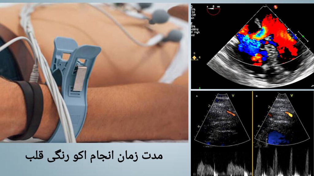 نمایی از انجام اکو قلب بیمار در زمان کوتاه