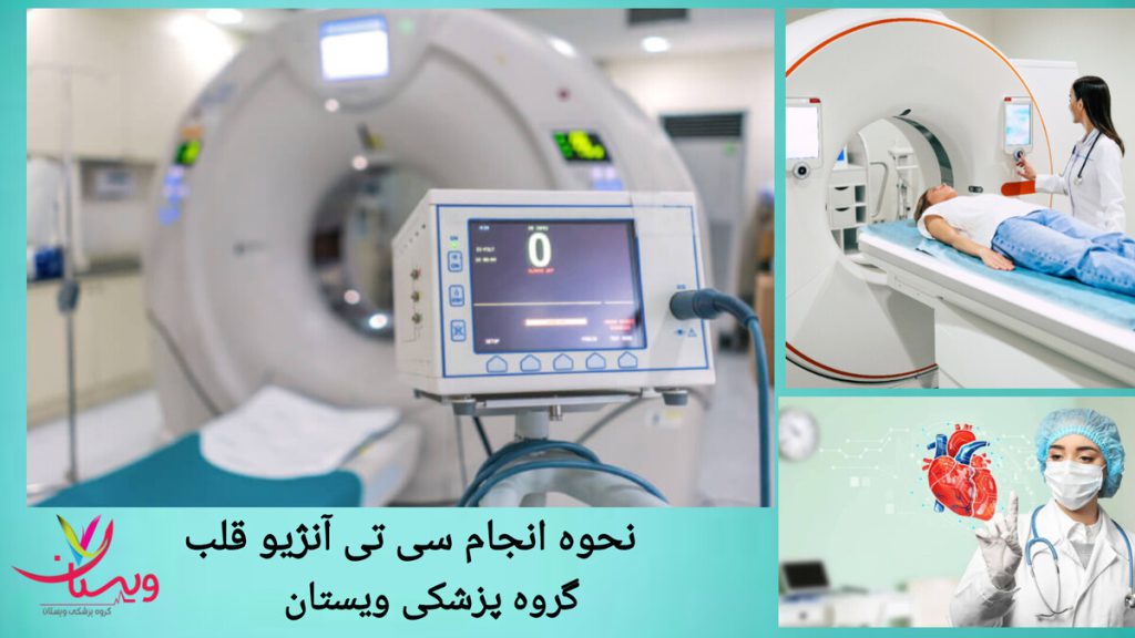 انجام سی تی آنژیو با دستگاه های پیشرفته نحوه انجام سی تی آنژیو قلب توسط پزشک