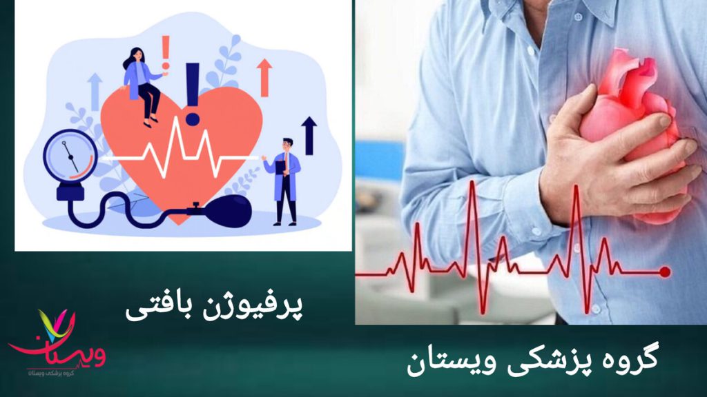 حمله قلبی به دلیل اختلال در پرفیوژن بافتی فردی به دلیل اختلال در پرفیوژن بافتی دچار حملات قلبی شده است.