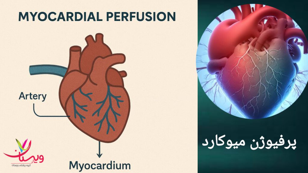 پرفیوژن میوکارد و نقش حیاتی آن در عملکرد بهینه قلب نمایی از قلب بیمار و پرفیوژن میوکارد