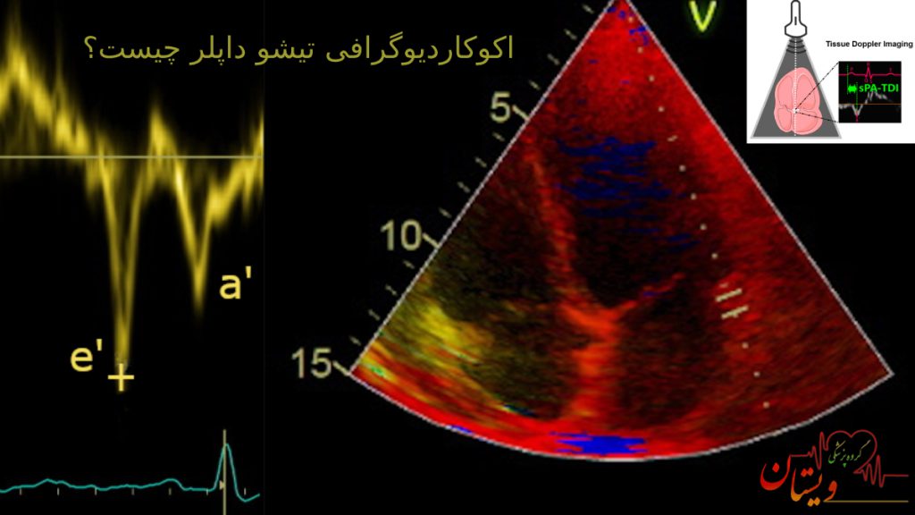 اکوکاردیوگرافی تیشو داپلر چیست؟
