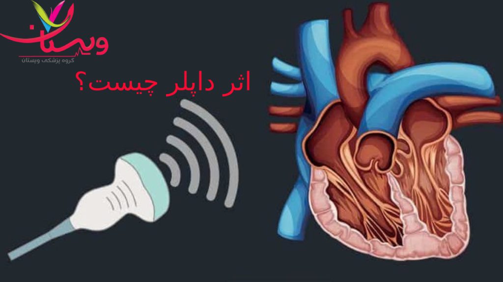 doppler effect تصویر انیمیشنی از قلب و دستگاه سونوی داپلر به همراه امواج صوتی برای اکوکاردیوگرافی تیشو داپلر