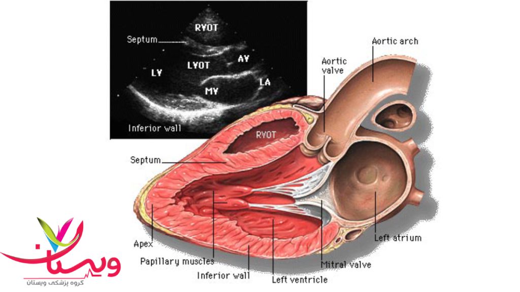 تصویری از اصطلاحات موجود در اکوی داپلر قلب