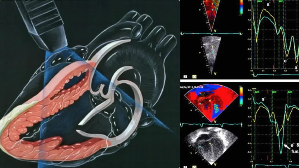eco doppler تصویری از گراف اکو داپلر رنگی قلب و نحوه انجام آن