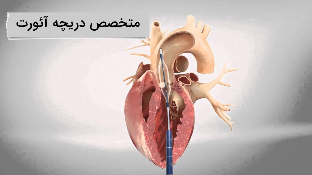 آشنایی با دریچه آئورت قلب