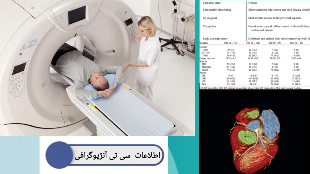 اطلاعات و جواب سی تی آنژیو قلب تصویری از جواب سی تی آنژیو قلب و پزشک در حال انجام سی تی آنژیو