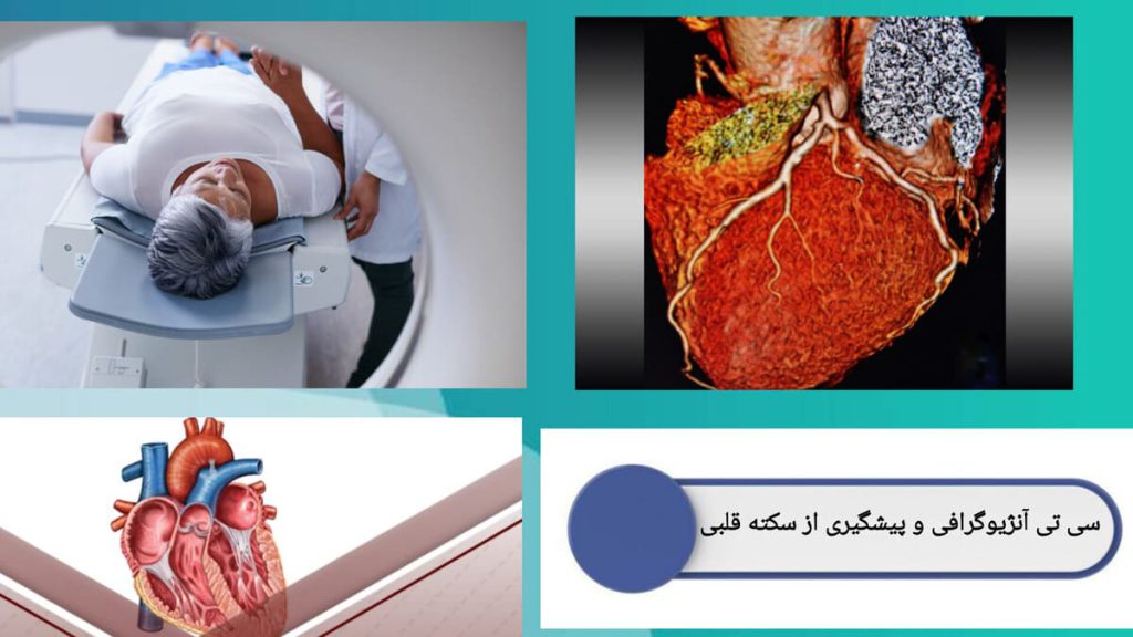 انجام سی تی آنژیو برای جلوگیری از سکته قلبی نمایی از قلب بیمار و انجام سی تی آنژیو برای پیشگیری از سکته قلبی