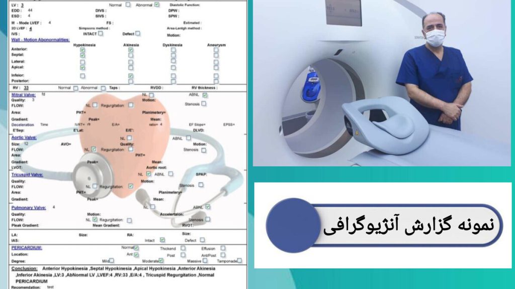 نمونه گزارش آنژیوگرافی قلب نمونه گزارش و تفسیر جواب سی تی آنژیوگرافی قلب