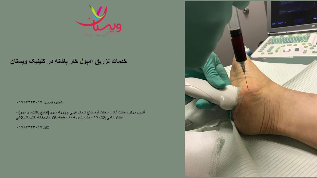 تزریق آمپول خار پاشنه