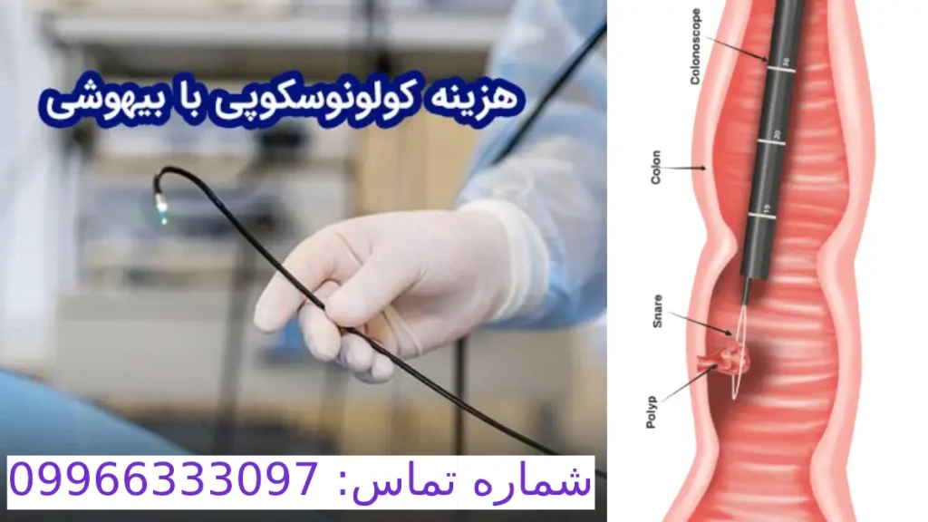 هزینه کولونوسکوپی با بیهوشی در سال 1404